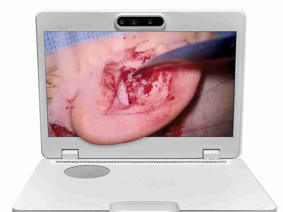 达擎之＂Heads-up 3D显微手术显示系统＂，，，，整合4K裸眼3D显示及眼球追踪系统，，，，具备快速追踪人眼移动位置功能，，，减轻医师长时间维持固定姿势的负担，，，让医师能有更宽广清晰的3D立体视野及更舒适的姿势来执行手术。。。